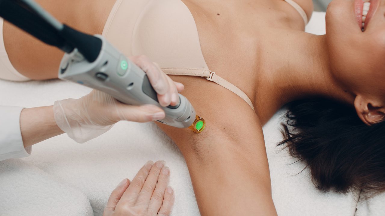 The Sun and Laser Hair Removal: Understanding the Effects
