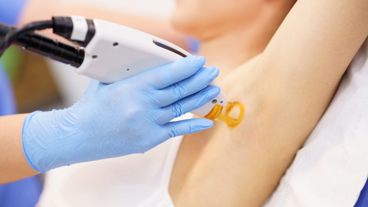 Why Does Laser Hair Removal Hurt? Understanding the Sensations and Pain Factors