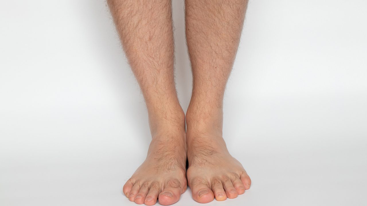 removing unwanted hair in the legs