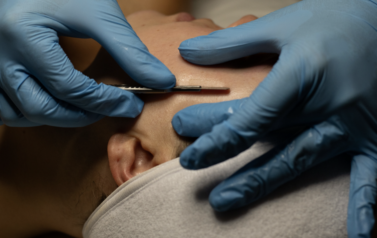 dermaplaning orange county