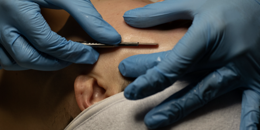 Dermaplaning – A Clear Guide for First-Time Patients